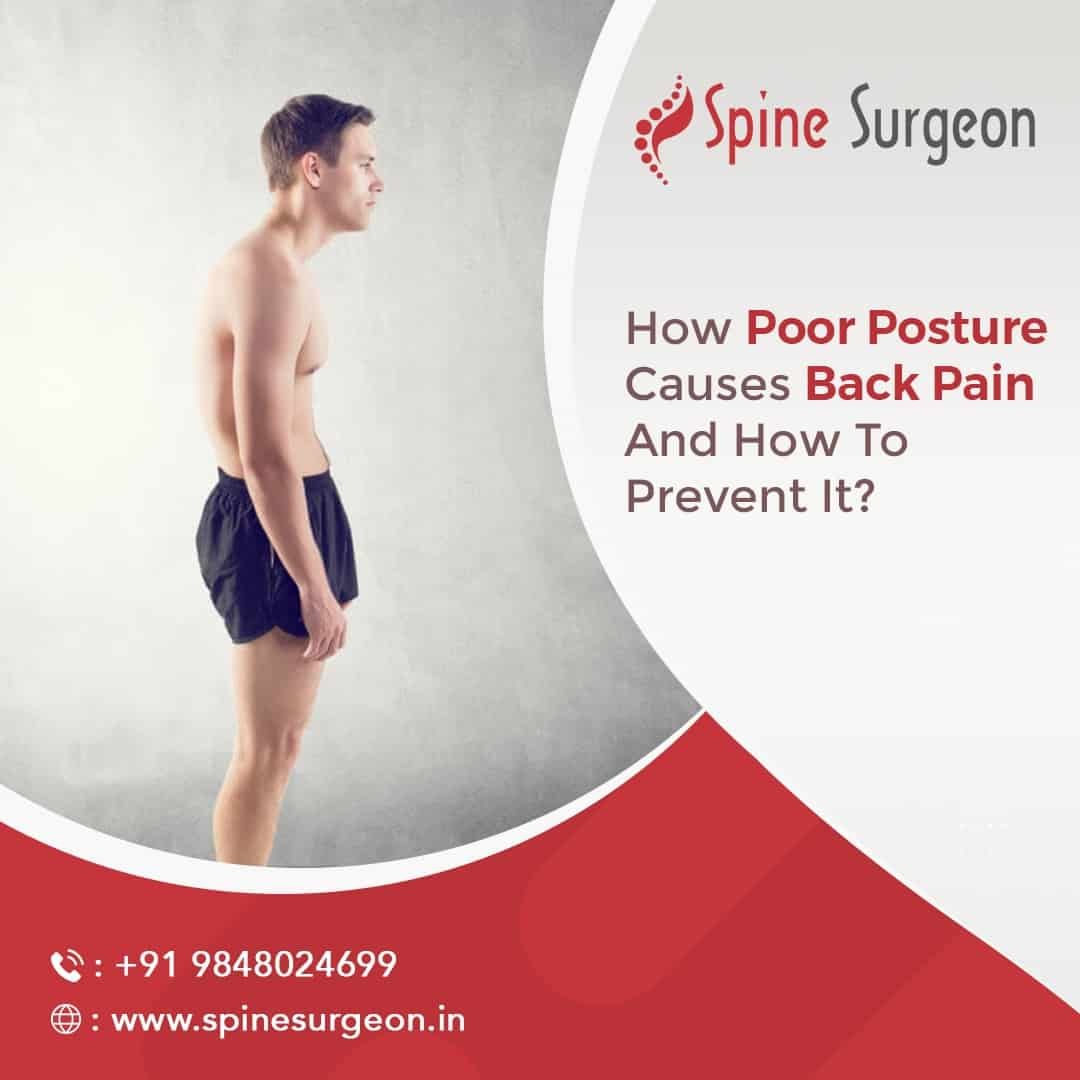 How poor posture causes back pain, and how to prevent it? Spine Surgeon